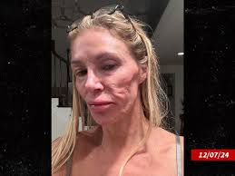 Brandi Glanville Life, Career, and Impact