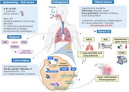 Understanding Legionnaires Disease Causes, Symptoms, and Prevention